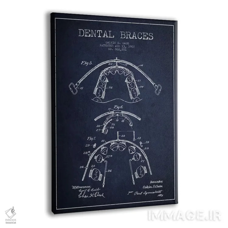 تابلو نقشهٔ ثبت اختراع براکت دندان آبی نفتی اثر پیکسل کهنه (استودیو/نام هنری) - نمای پرسپکتیو محصول