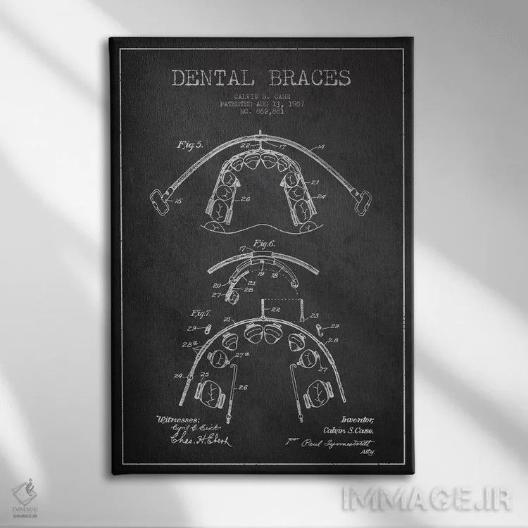 تابلو نقشهٔ ثبت اختراع براکت دندان خاکستری اثر پیکسل کهنه (استودیو/نام هنری) - نمای روبهرو روی دیوار