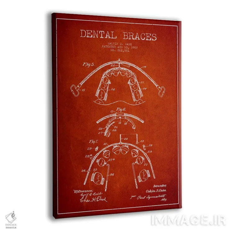 تابلو نقشهٔ ثبت اختراع براکت دندان قرمز اثر پیکسل کهنه (استودیو/نام هنری) - نمای پرسپکتیو محصول