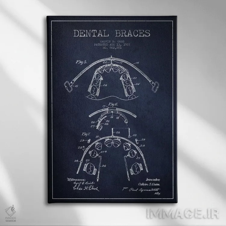 تابلو نقشهٔ ثبت اختراع براکت دندان آبی نفتی اثر پیکسل کهنه (استودیو/نام هنری) - نمای روبهرو روی دیوار