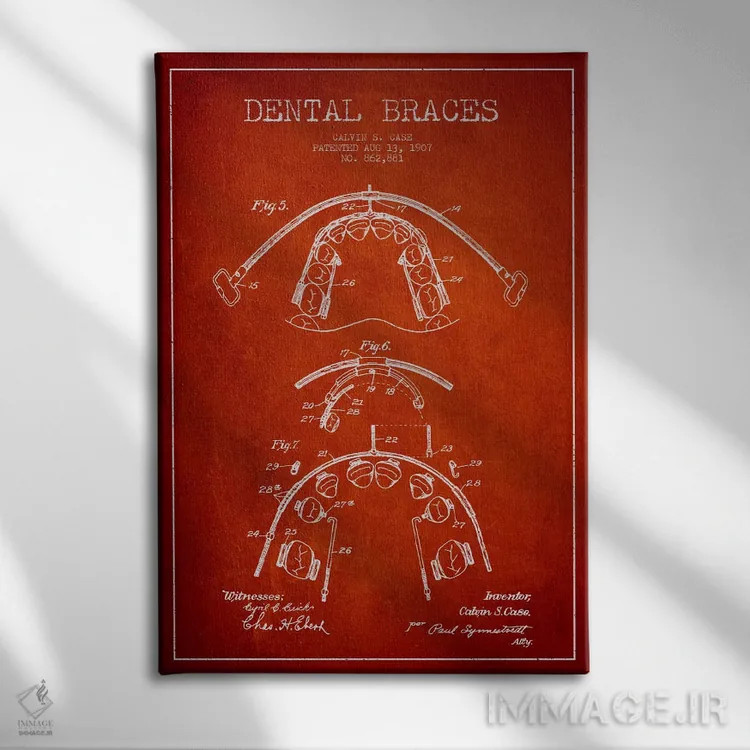 تابلو نقشهٔ ثبت اختراع براکت دندان قرمز اثر پیکسل کهنه (استودیو/نام هنری) - نمای روبهرو روی دیوار