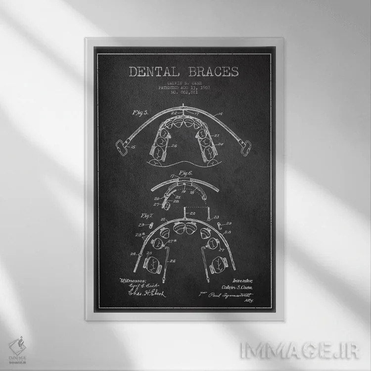تابلو نقشهٔ ثبت اختراع براکت دندان خاکستری اثر پیکسل کهنه (استودیو/نام هنری) - نمای قابدار سفید