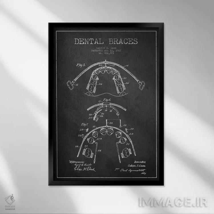 تابلو نقشهٔ ثبت اختراع براکت دندان خاکستری اثر پیکسل کهنه (استودیو/نام هنری) - نمای قابدار مشکی