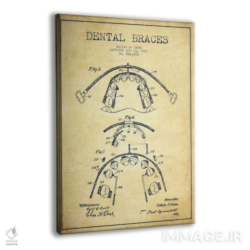 تابلو نقشهٔ ثبت اختراع براکت دندان (طرح کلاسیک) اثر پیکسل کهنه (استودیو/نام هنری) - نمای پرسپکتیو محصول