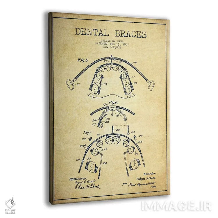 تابلو نقشهٔ ثبت اختراع براکت دندان (طرح کلاسیک) اثر پیکسل کهنه (استودیو/نام هنری) - نمای پرسپکتیو محصول