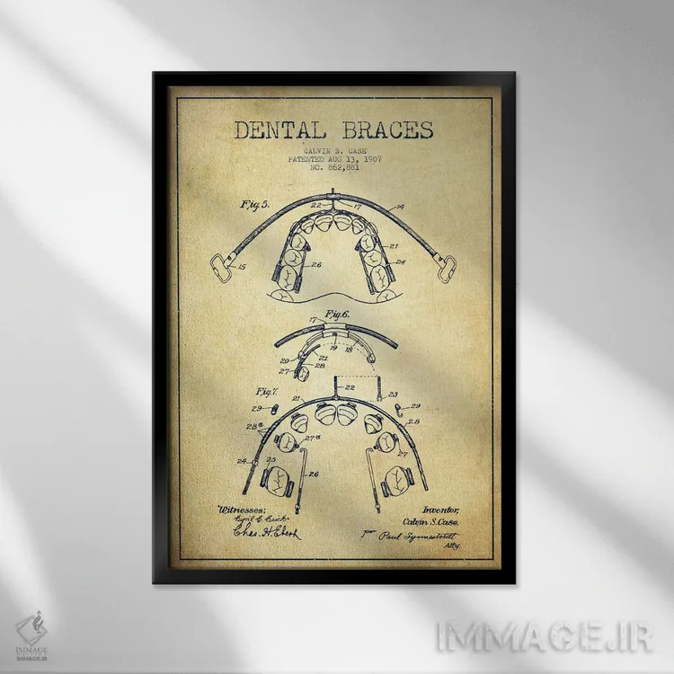تابلو نقشهٔ ثبت اختراع براکت دندان (طرح کلاسیک) اثر پیکسل کهنه (استودیو/نام هنری) - نمای قابدار مشکی