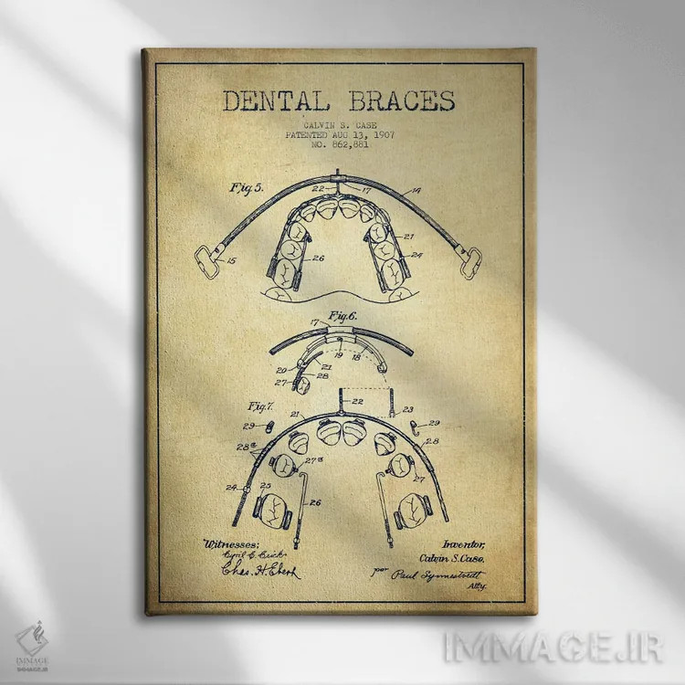 تابلو نقشهٔ ثبت اختراع براکت دندان (طرح کلاسیک) اثر پیکسل کهنه (استودیو/نام هنری) - نمای روبهرو روی دیوار