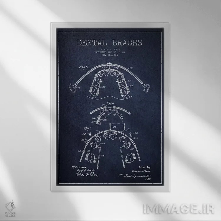 تابلو نقشهٔ ثبت اختراع براکت دندان آبی نفتی اثر پیکسل کهنه (استودیو/نام هنری) - نمای قابدار سفید