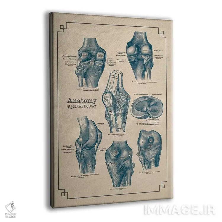 تابلو دکوراتیو آناتومی مفصل زانو اثر چارت اسمارت دکور - نمای پرسپکتیو محصول