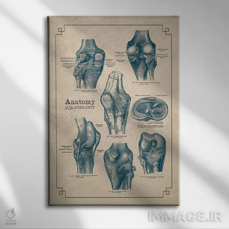 تابلو دکوراتیو آناتومی مفصل زانو اثر چارت اسمارت دکور - نمای روبهرو روی دیوار