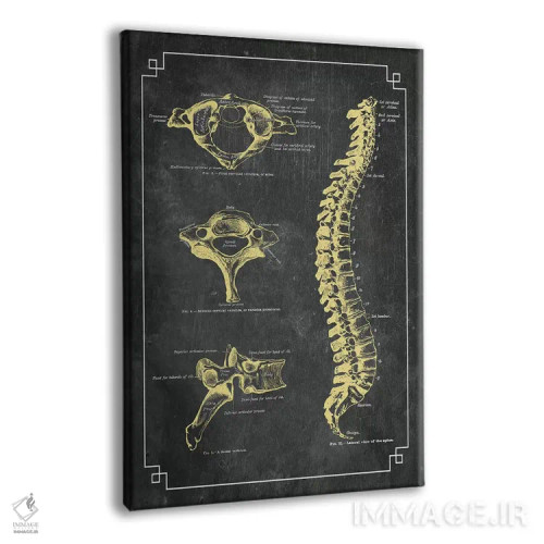 تابلو دکوراتیو استخوان های ستون فقرات اثر چارت اسمارت دکور - نمای پرسپکتیو محصول