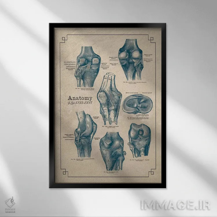 تابلو دکوراتیو آناتومی مفصل زانو اثر چارت اسمارت دکور - نمای قابدار مشکی