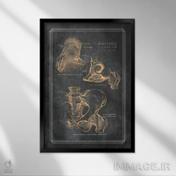 تابلو دکوراتیو آناتومی لگن و مفصل ران اثر چارت اسمارت دکور - نمای قابدار مشکی