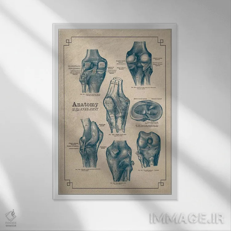 تابلو دکوراتیو آناتومی مفصل زانو اثر چارت اسمارت دکور - نمای قابدار سفید