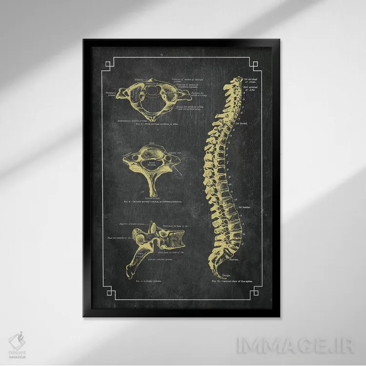 تابلو دکوراتیو استخوان های ستون فقرات اثر چارت اسمارت دکور - نمای قابدار مشکی