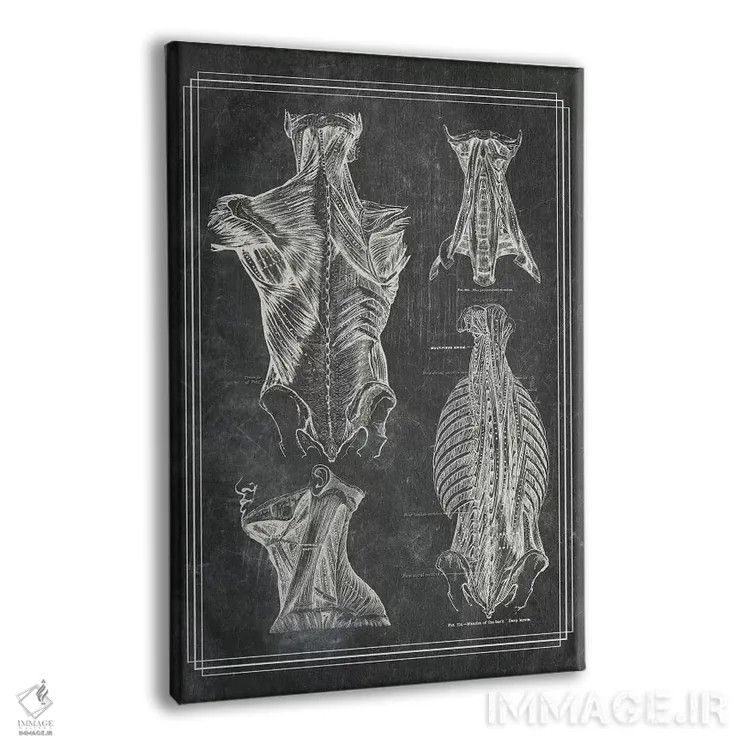 تابلو دکوراتیو عضلات کمر و گردن ۱ اثر چارت اسمارت دکور - نمای پرسپکتیو محصول