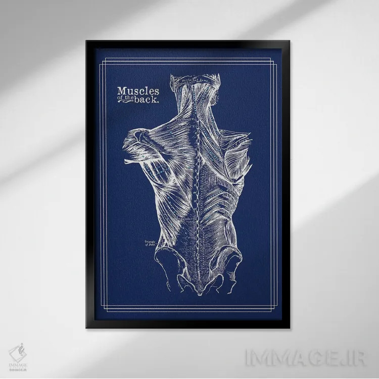 تابلو دکوراتیو عضلات کمر اثر چارت اسمارت دکور - نمای قابدار مشکی