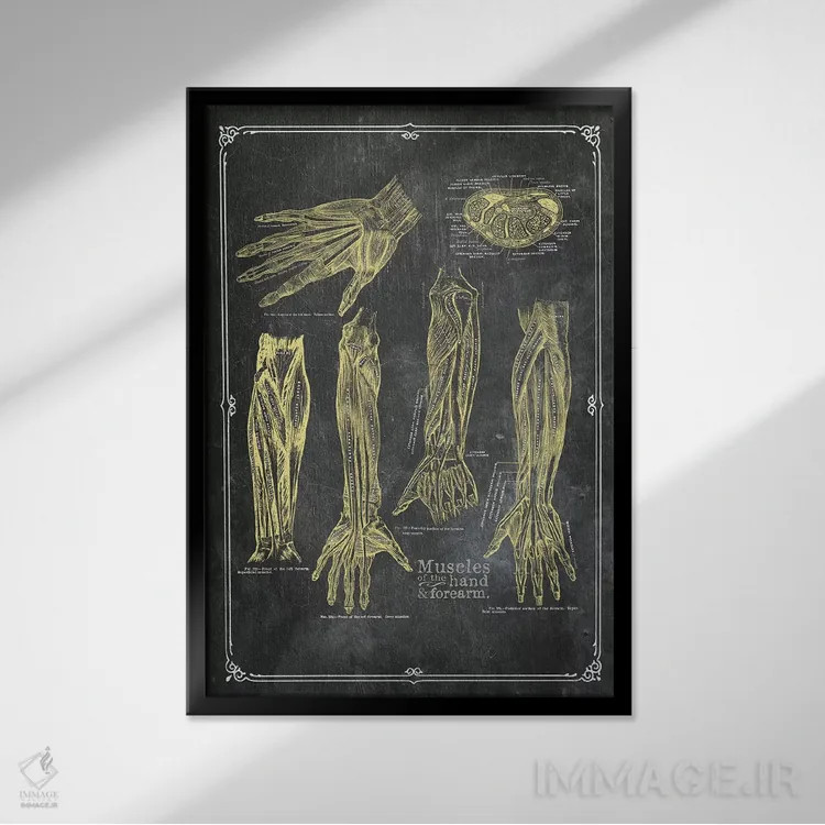 تابلو دکوراتیو عضلات بازو و دست با گچ زرد اثر چارت اسمارت دکور - نمای قابدار مشکی