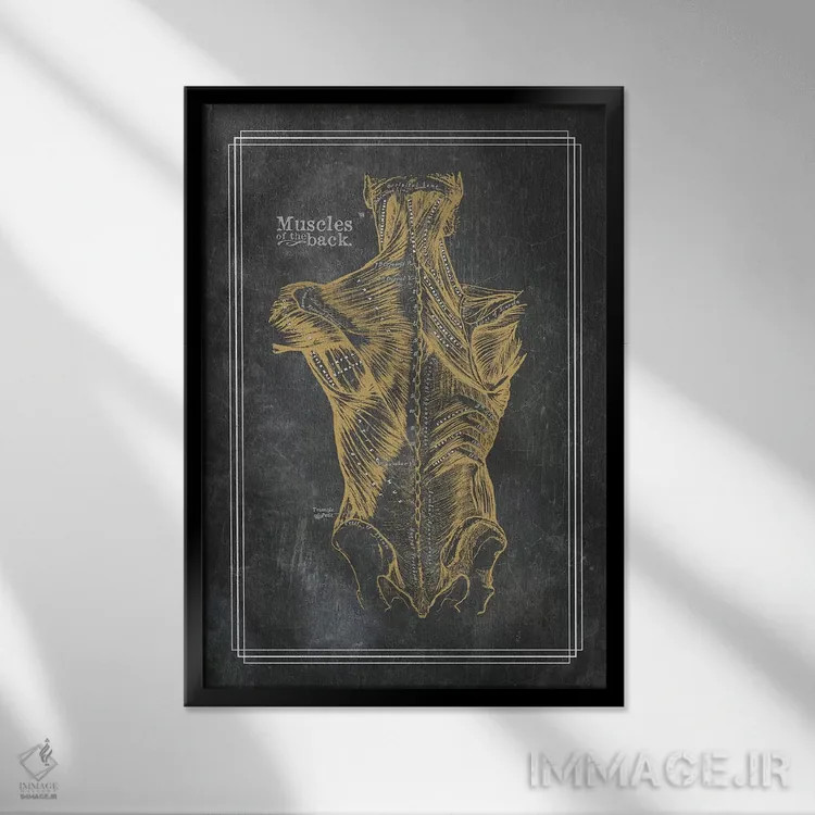 تابلو دکوراتیو عضلات کمر با برنز اثر چارت اسمارت دکور - نمای قابدار مشکی