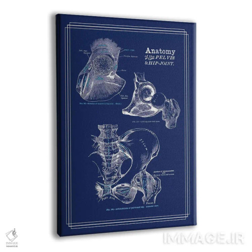 تابلو دکوراتیو آناتومی مفصل ران اثر چارت اسمارت دکور - نمای پرسپکتیو محصول
