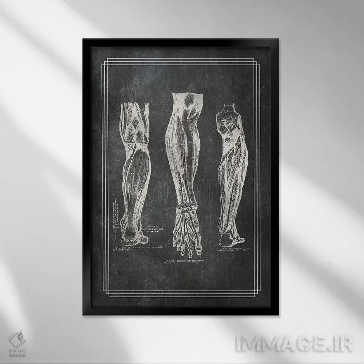 تابلو دکوراتیو عضلات ساق پا اثر چارت اسمارت دکور - نمای قابدار مشکی