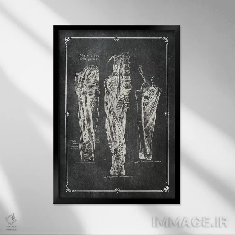 تابلو دکوراتیو عضلات ران اثر چارت اسمارت دکور - نمای قابدار مشکی