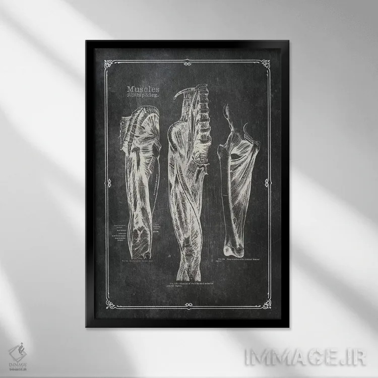 تابلو دکوراتیو عضلات ران اثر چارت اسمارت دکور - نمای قابدار مشکی