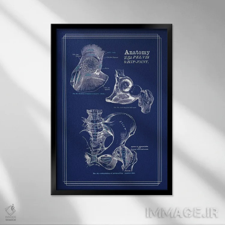 تابلو دکوراتیو آناتومی مفصل ران اثر چارت اسمارت دکور - نمای قابدار مشکی