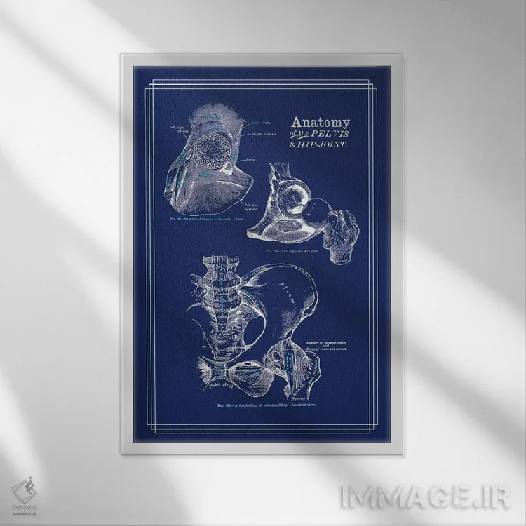 تابلو دکوراتیو آناتومی مفصل ران اثر چارت اسمارت دکور - نمای قابدار سفید