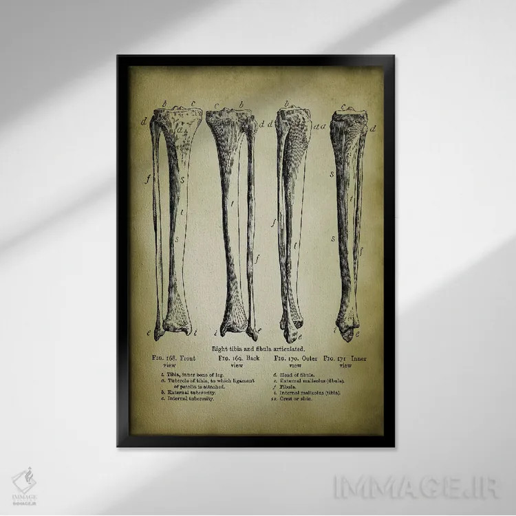 تابلو دکوراتیو استخوان های پا اثر پتنت پرینت استور - نمای قابدار مشکی